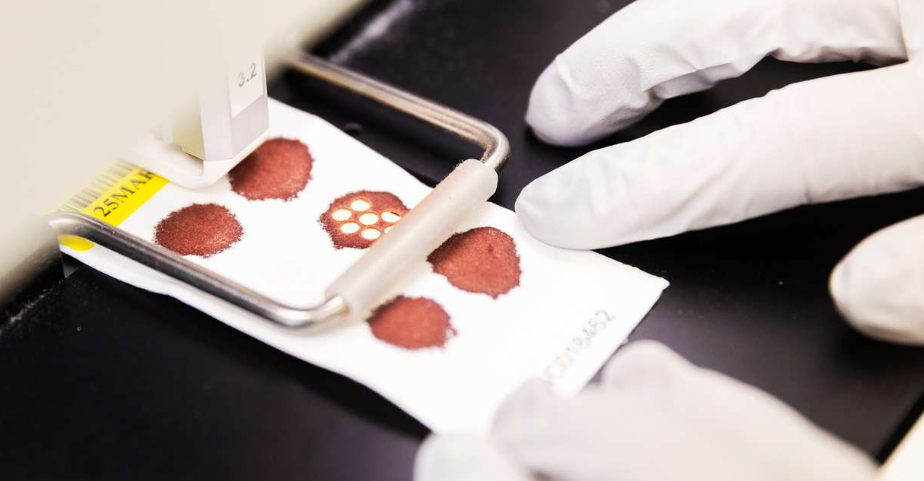 PKU-kort med tørrede blodpletter analyseres i laboratoriet af en person med engangshandsker.