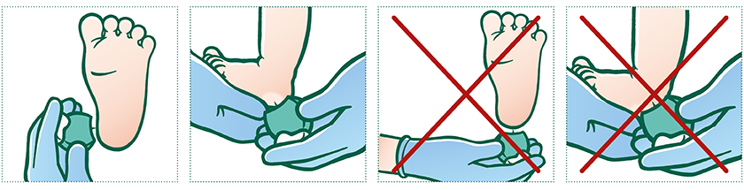 Stik det helt rigtige sted.  Brug en lancet til at stikke med. Stikket skal foretages på en af siderne af hælen i det bløde område lige over fodsålen. Det skal være under 3 mm dybt. Stik aldrig bag på hælen eller i nærheden af barnets ankelknogler. 
