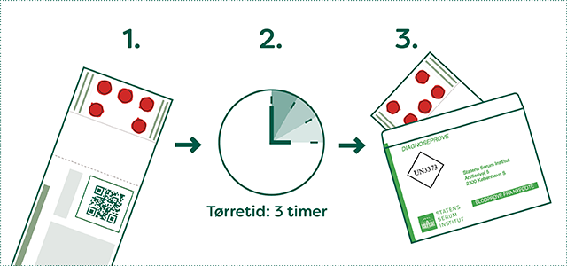 Prøven skal tørre helt. Det er vigtigt, at blodet på filterpapiret er helt tørt inden det sendes til SSI. Blodpletterne skal tørre ved stuetemperatur i ca. tre timer. Undgå direkte sollys og varme. Brug helst SSI’s særlige til PKU-prøvekuvert, mærket med ”Blodprøve fra nyfødte”